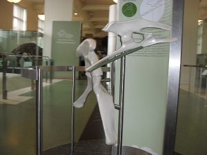 Peo's photo of the backward-pointing pubis model.